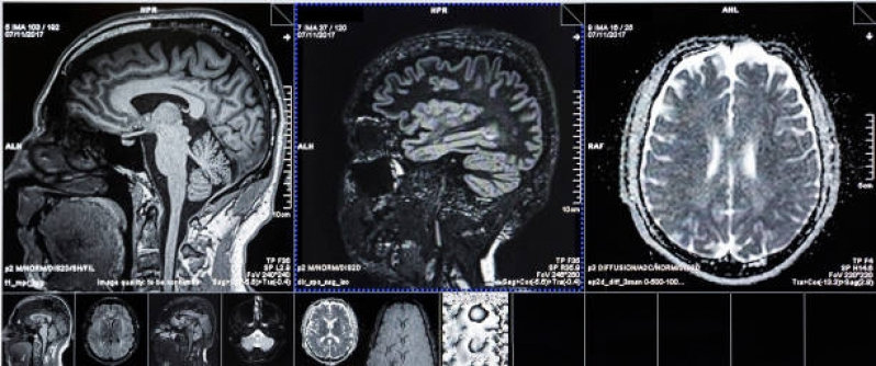 Agendar Exame de Angiorressonância Cerebral Saúde - Angiorressonância de Encéfalo