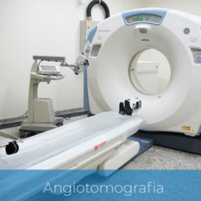 Agendar Exame de Angiorressonância Cervical Butantã - Angiorressonância Cerebral Arterial