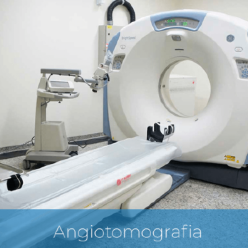 Angiorressonância Cardíaca Serra da Cantareira - Angiorressonância Arterial do Crânio