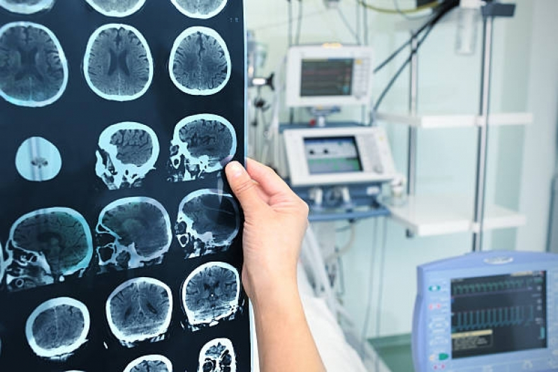 Clínica de Angiotomografia do Crânio Butantã - Angiotomografia Cerebral