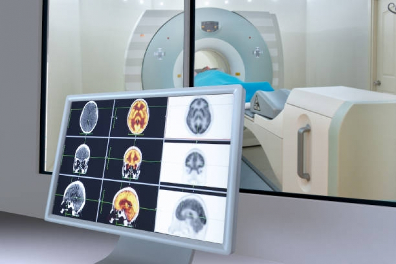 Clínica de Exame Ressonância Magnética do Crânio Campo Grande - Exame Ressonância da Cabeça