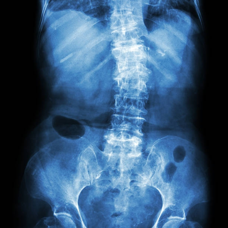 Clínica de Tomografia da Coluna Moema - Tomografia de Crânio