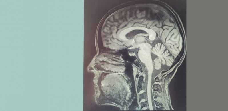 Clínica de Tomografia da Face Embu das Artes - Tomografia Pulmonar