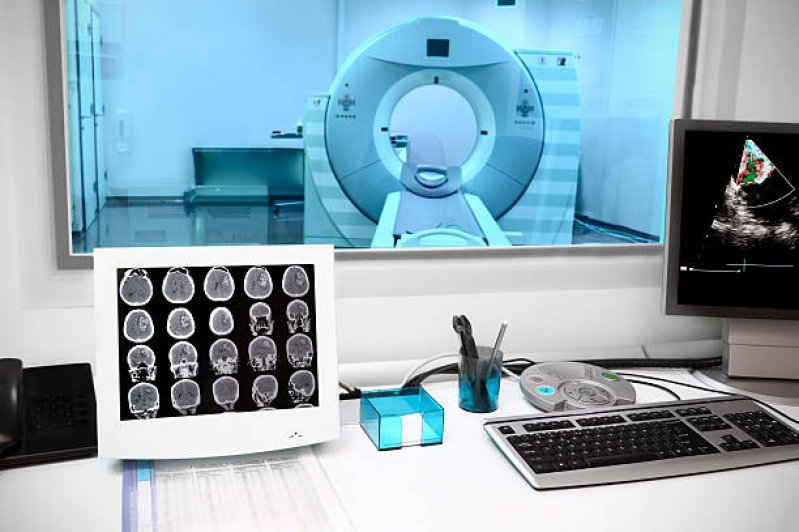 Clínicas Que Fazem Exame de Tomografia Computadorizada Alto da Boa Vista - Exame Tomografia do Crânio