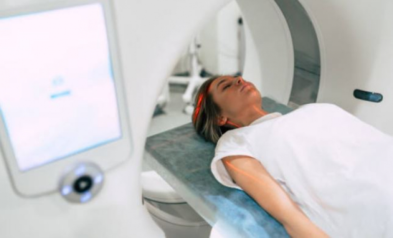 Exame de Ressonância Magnética do Crânio Real Parque - Exame de Ressonância Magnética do Crânio