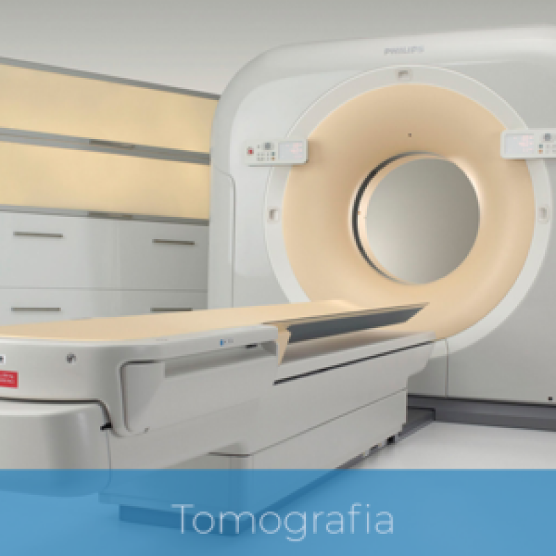 Exame de Tomografia Computadorizada Glicério - Exame Tomografia Coluna Lombar