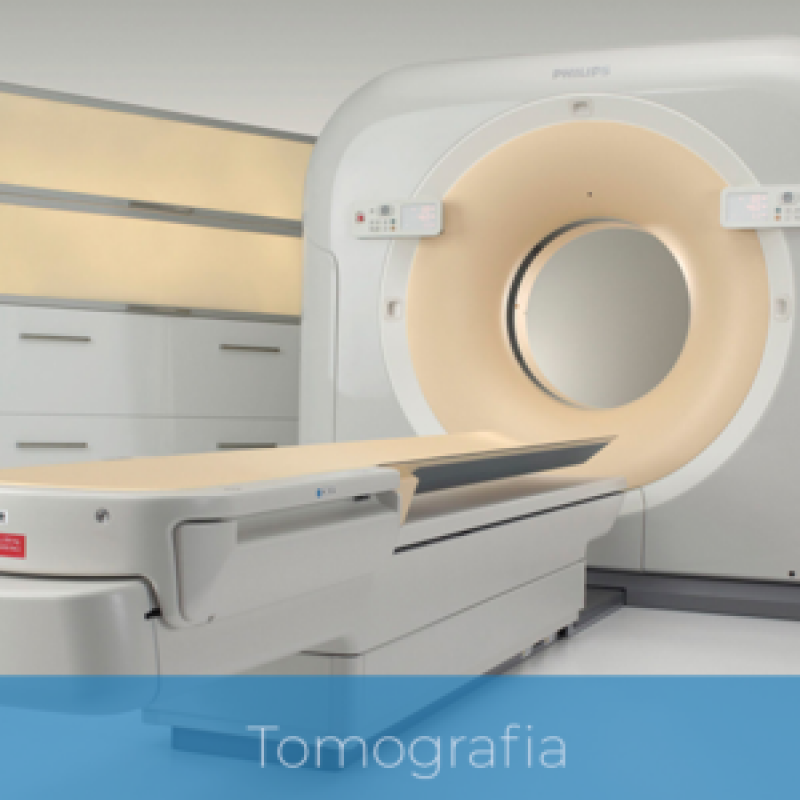 Exame de Tomografia Computadorizada Sé - Exame Tomografia do Crânio