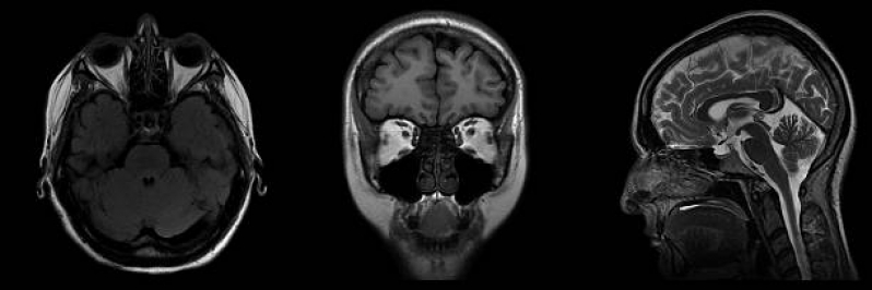 Exame de Tomografia da Face Serra da Cantareira - Tomografia Cerebral