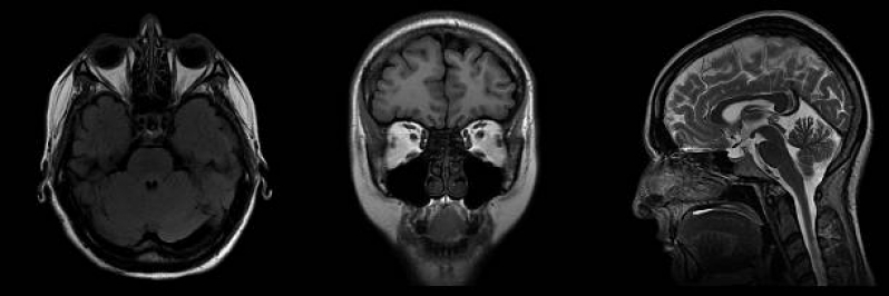 Exame de Tomografia da Face Carandiru - Tomografia da Coluna Lombar