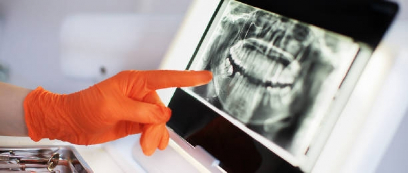 Exame de Tomografia Odontológica Alphaville - Tomografia da Face
