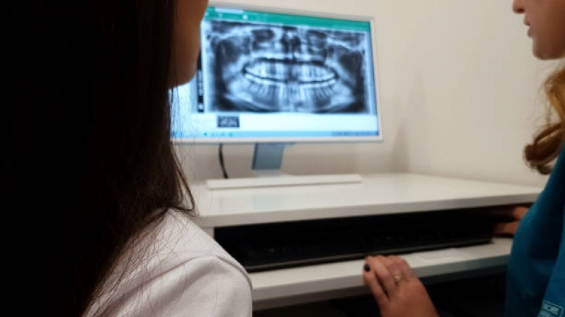 Exame Tomografia Maxilar Consolação - Exame Tomografia da Face