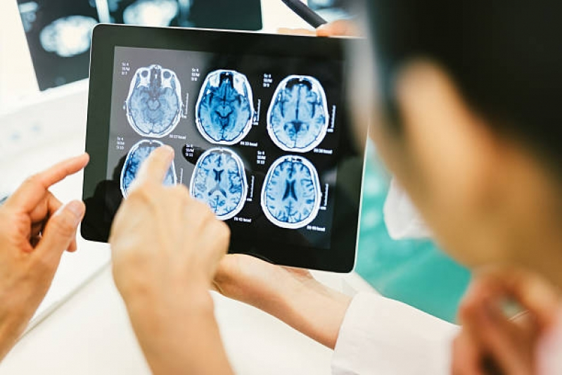 Marcar Exame de Angiorressonância de Crânio Juquitiba - Angiorressonância Cerebral Arterial