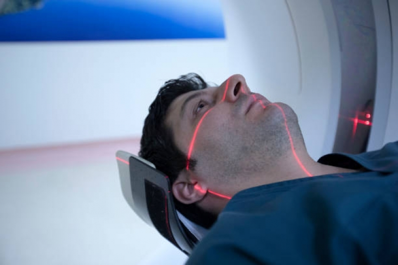 Onde Faz Tomografia Computadorizada de Crânio Aeroporto - Tomografia Computadorizada da Face
