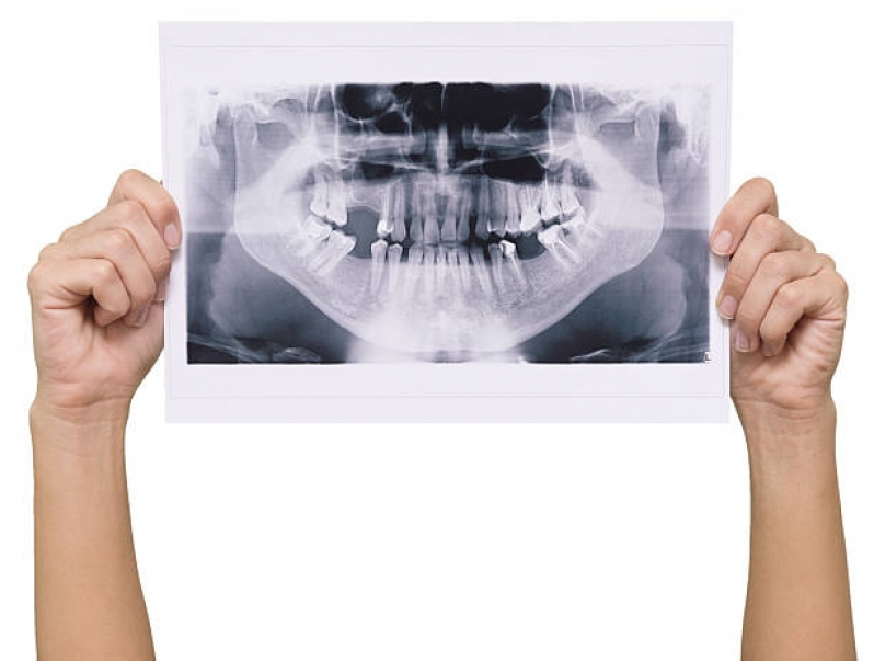 Onde Faz Tomografia Computadorizada Odontológica Osasco - Tomografia Computadorizada dos Seios da Face
