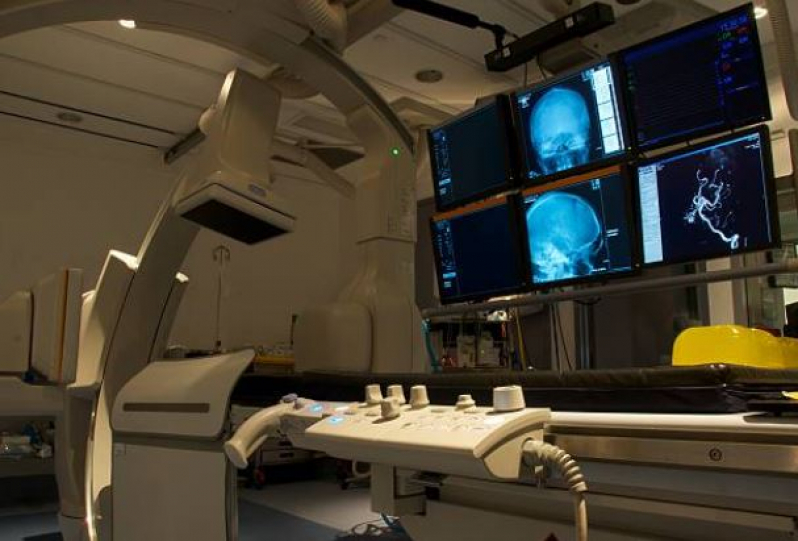 Onde Fazer Exame de Angiorressonância Arterial de Crânio Indianópolis - Exame de Angioressonancia Arterial Cerebral
