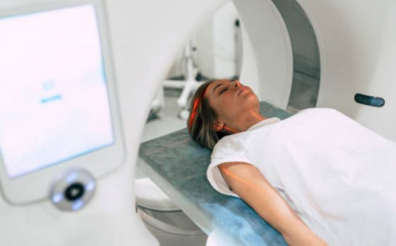 Onde Fazer Ressonância Magnética de Crânio com Sedação Parque Mandaqui - Sedativo para Ressonância Magnética