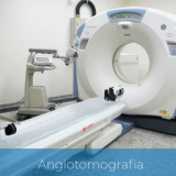 agendar exame de angiorressonância cervical Serra da Cantareira