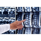 agendar exame de ressonância magnética da coluna Itaim Bibi