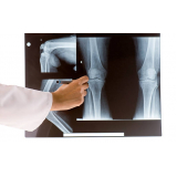 agendar exame de ressonância magnética do joelho Paineiras do Morumbi