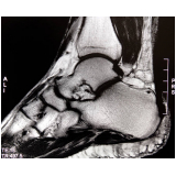 agendar exame de ressonância magnética do tornozelo Bela Vista