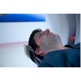 agendar exame ressonância magnética do crânio Consolação