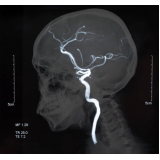 clínica de angiotomografia arterial de crânio Lapa