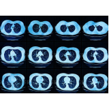 clínica de angiotomografia pulmonar Salesópolis