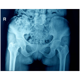 clínica de exame ressonância magnética da pelve Vila Pompeia