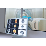 clínica de exame ressonância magnética do crânio Perus