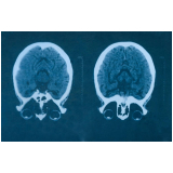 clínica de tomografia cerebral Jardins