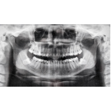 clínica de tomografia odontológica Santana de Parnaíba