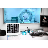 clínicas que fazem exame de tomografia computadorizada Alto da Boa Vista