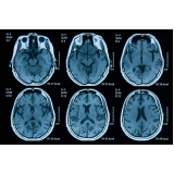 exame de tomografia cerebral República