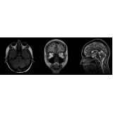 exame de tomografia da face Barueri