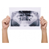 exames tomografias maxilar Pinheiros