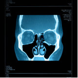 onde faz tomografia computadorizada dos seios da face Cidade Dutra