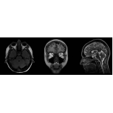 onde fazer tomografia computadorizada da face Chácara Inglesa