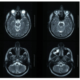 onde fazer tomografia computadorizada do crânio Jandira
