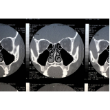 onde fazer tomografia computadorizada dos seios da face Carandiru