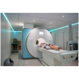 preço de exame de tomografia Vila Mazzei