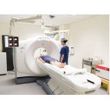 preço de exame tomografia Cajamar
