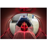 preço de tomografia do abdomem Campo Grande