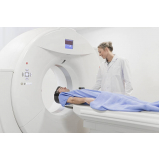 realizar exame tomografia computadorizada Santa Cecília