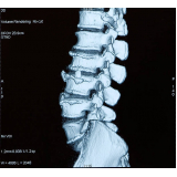 ressonância magnética da coluna Osasco