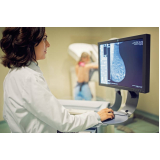 ressonância magnética de mamas Saúde