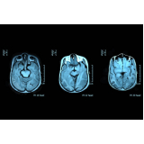 ressonância magnética do cérebro clínicas Butantã