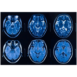 ressonância magnética do cérebro Vila Medeiros