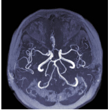 ressonância magnética do encéfalo Itaim Bibi