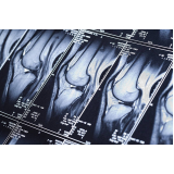 ressonância magnética do joelho Biritiba Mirim