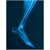 ressonância magnética do tornozelo clínicas Pedreira